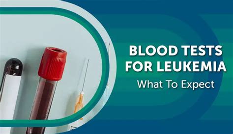Blood Tests for Leukemia: What To Expect.